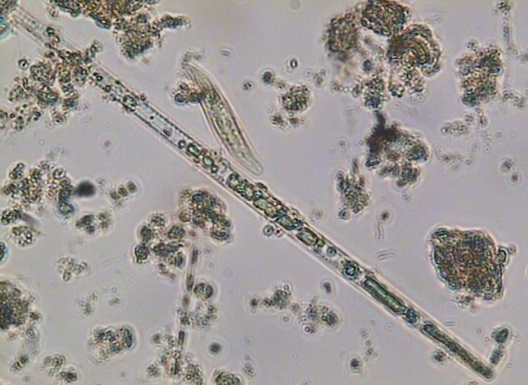 Dictyocha speculum